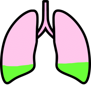 RAID Lungs