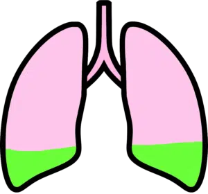 RAID Lungs